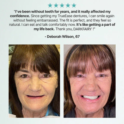🌎🏆Ends Today: 70% OFF! 🏆2026 Bestselling Product🦷 Fit for a Fresh Smile, Say Goodbye to Wearing Discomfort!